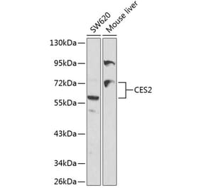 Western Blot - Anti-CES2 Antibody (A11455) - Antibodies.com