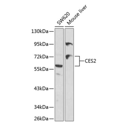 Western Blot - Anti-CES2 Antibody (A11455) - Antibodies.com