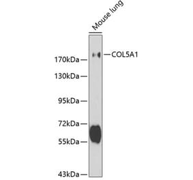 Western Blot - Anti-Collagen V Antibody (A11456) - Antibodies.com