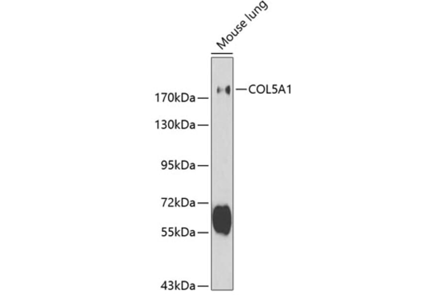 Western Blot - Anti-Collagen V Antibody (A11456) - Antibodies.com