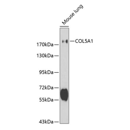 Western Blot - Anti-Collagen V Antibody (A11456) - Antibodies.com