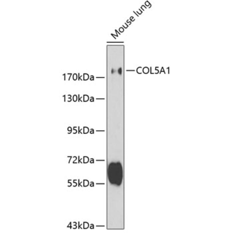 Western Blot - Anti-Collagen V Antibody (A11456) - Antibodies.com