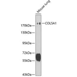 Western Blot - Anti-Collagen V Antibody (A11456) - Antibodies.com