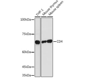 Western Blot - Anti-CD4 Antibody (A11458) - Antibodies.com