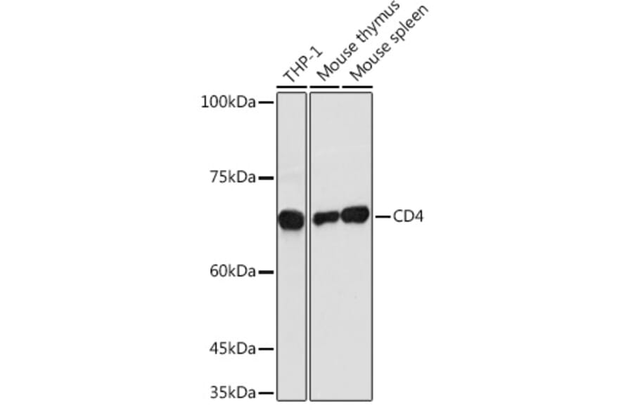 Western Blot - Anti-CD4 Antibody (A11458) - Antibodies.com