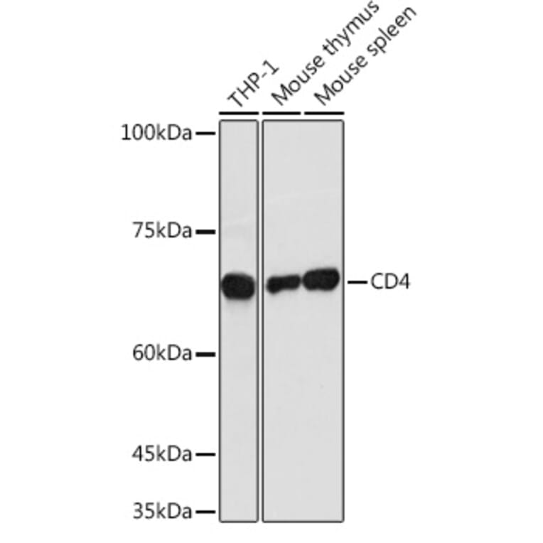 Western Blot - Anti-CD4 Antibody (A11458) - Antibodies.com