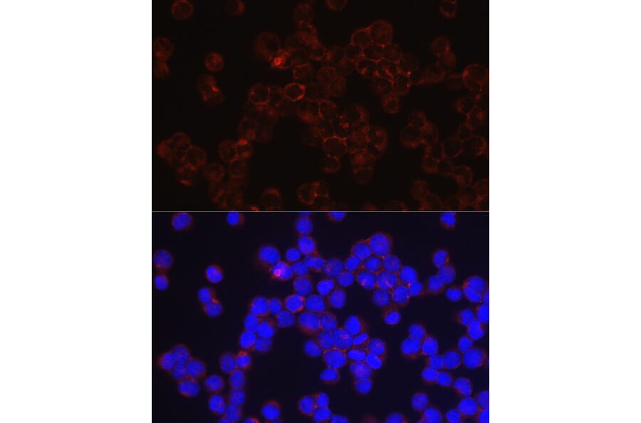 Immunofluorescence - Anti-CD4 Antibody (A11458) - Antibodies.com