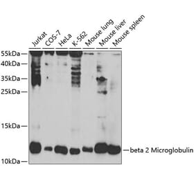 Western Blot - Anti-beta 2 Microglobulin Antibody (A11459) - Antibodies.com