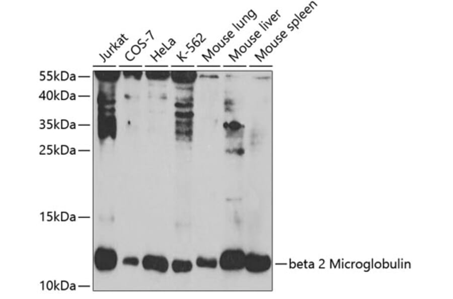 Western Blot - Anti-beta 2 Microglobulin Antibody (A11459) - Antibodies.com