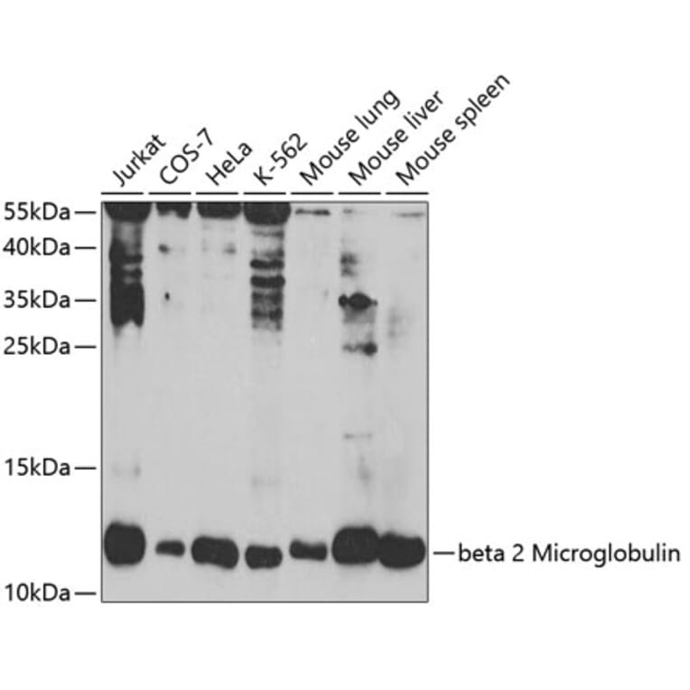 Western Blot - Anti-beta 2 Microglobulin Antibody (A11459) - Antibodies.com