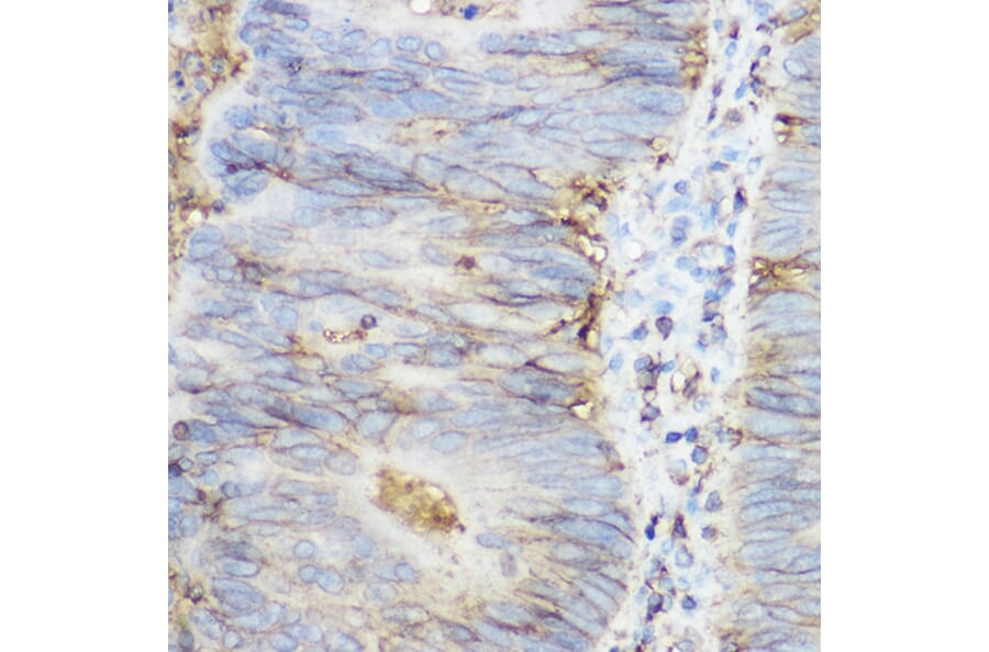 Immunohistochemistry - Anti-beta 2 Microglobulin Antibody (A11459) - Antibodies.com
