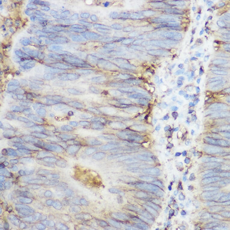 Immunohistochemistry - Anti-beta 2 Microglobulin Antibody (A11459) - Antibodies.com