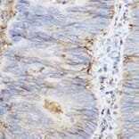 Immunohistochemistry - Anti-beta 2 Microglobulin Antibody (A11459) - Antibodies.com