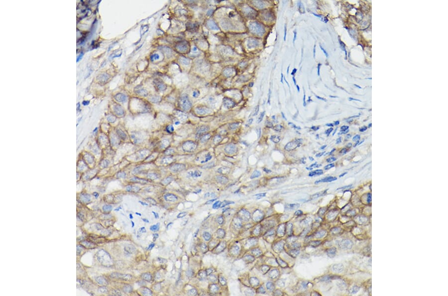 Immunohistochemistry - Anti-CD147 Antibody (A11460) - Antibodies.com
