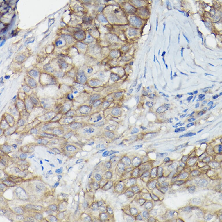 Immunohistochemistry - Anti-CD147 Antibody (A11460) - Antibodies.com