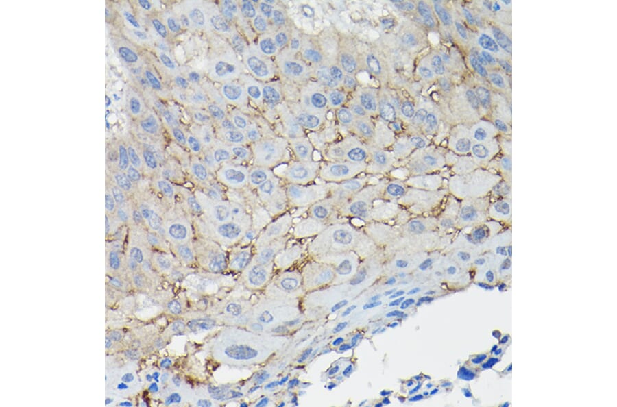 Immunohistochemistry - Anti-CD147 Antibody (A11460) - Antibodies.com