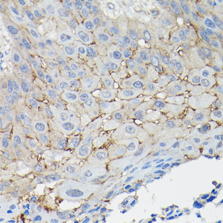 Immunohistochemistry - Anti-CD147 Antibody (A11460) - Antibodies.com