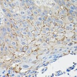 Immunohistochemistry - Anti-CD147 Antibody (A11460) - Antibodies.com