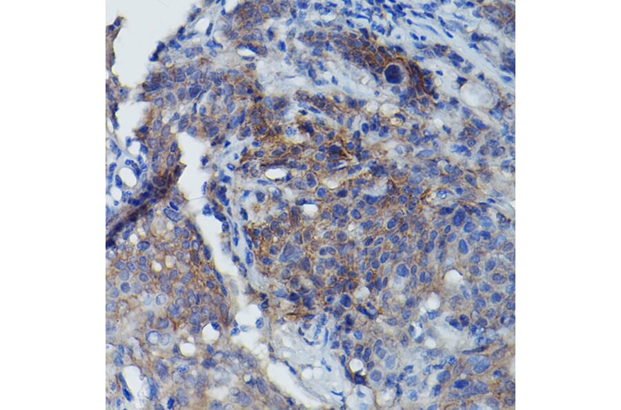 Immunohistochemistry - Anti-CD147 Antibody (A11460) - Antibodies.com