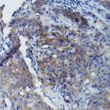 Immunohistochemistry - Anti-CD147 Antibody (A11460) - Antibodies.com