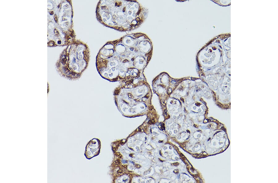 Immunohistochemistry - Anti-CD147 Antibody (A11460) - Antibodies.com