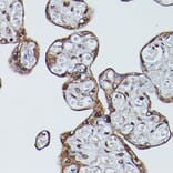 Immunohistochemistry - Anti-CD147 Antibody (A11460) - Antibodies.com