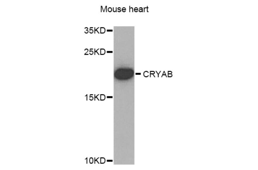 Western Blot - Anti-CRYAB Antibody (A1591) - Antibodies.com