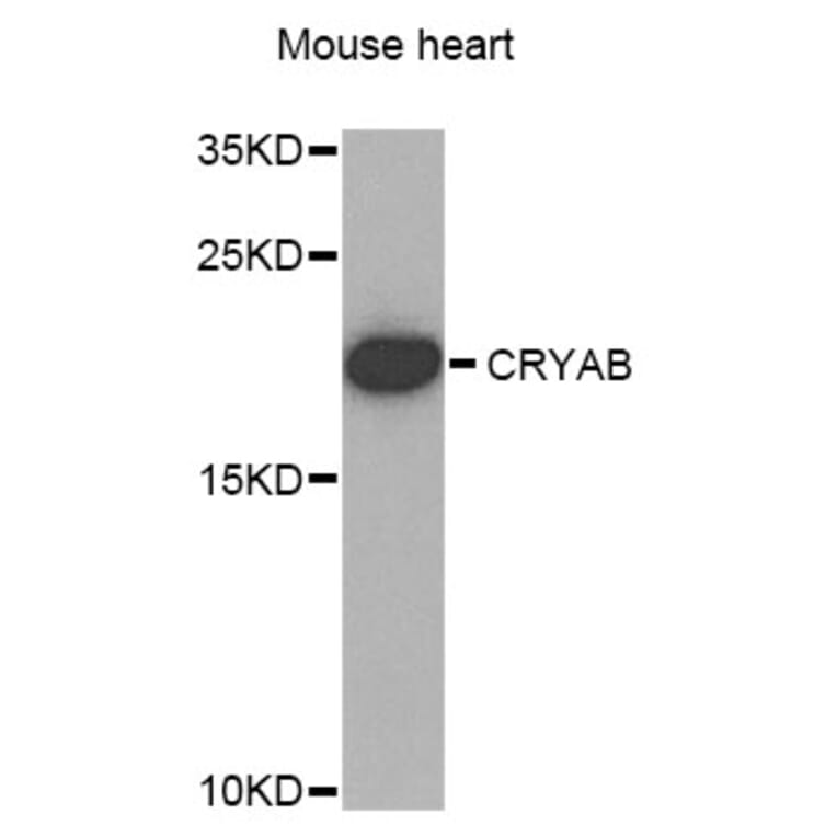 Western Blot - Anti-CRYAB Antibody (A1591) - Antibodies.com
