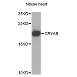 Western Blot - Anti-CRYAB Antibody (A1591) - Antibodies.com