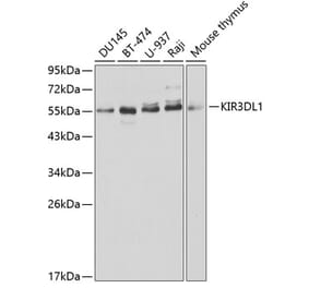 Western Blot - Anti-KIR3DL1 Antibody (A1617) - Antibodies.com