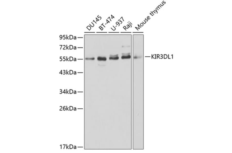 Western Blot - Anti-KIR3DL1 Antibody (A1617) - Antibodies.com