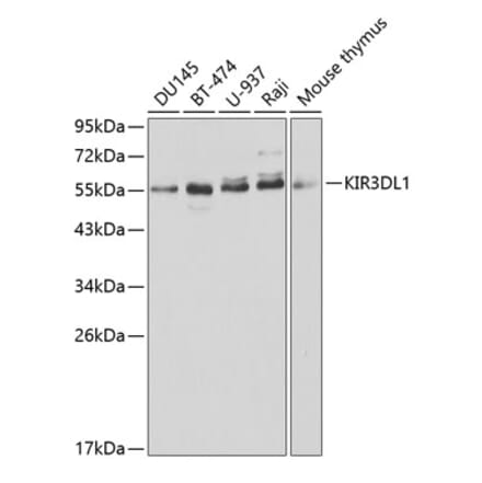 Western Blot - Anti-KIR3DL1 Antibody (A1617) - Antibodies.com