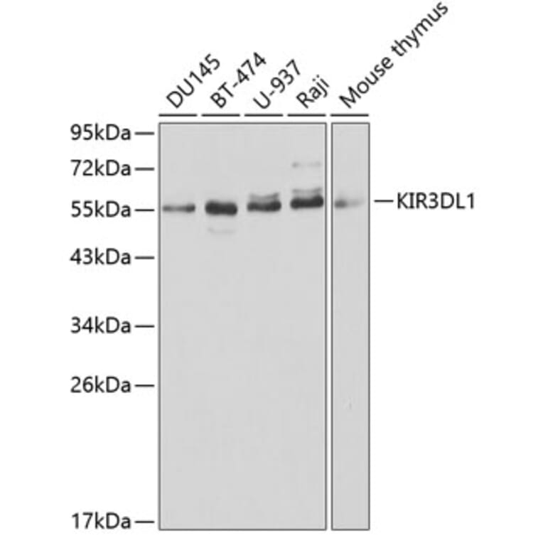 Western Blot - Anti-KIR3DL1 Antibody (A1617) - Antibodies.com