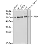 Western Blot - Anti-KIR3DL1 Antibody (A1617) - Antibodies.com