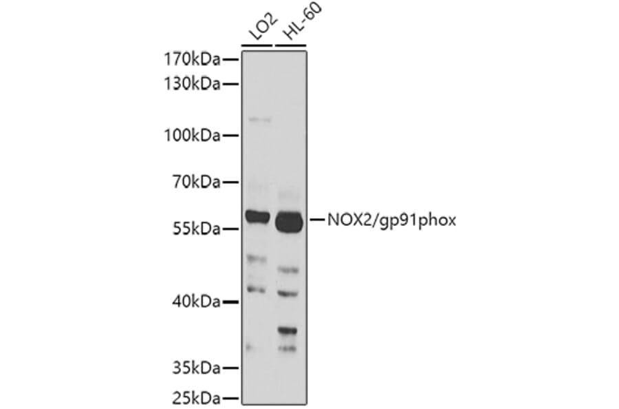 Western Blot - Anti-NOX2/gp91phox Antibody (A11464) - Antibodies.com