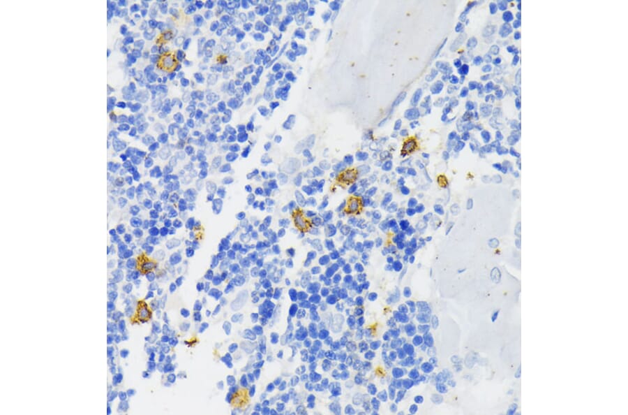 Immunohistochemistry - Anti-NOX2/gp91phox Antibody (A11464) - Antibodies.com