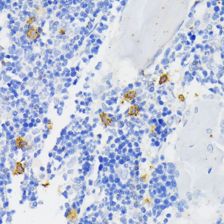 Immunohistochemistry - Anti-NOX2/gp91phox Antibody (A11464) - Antibodies.com