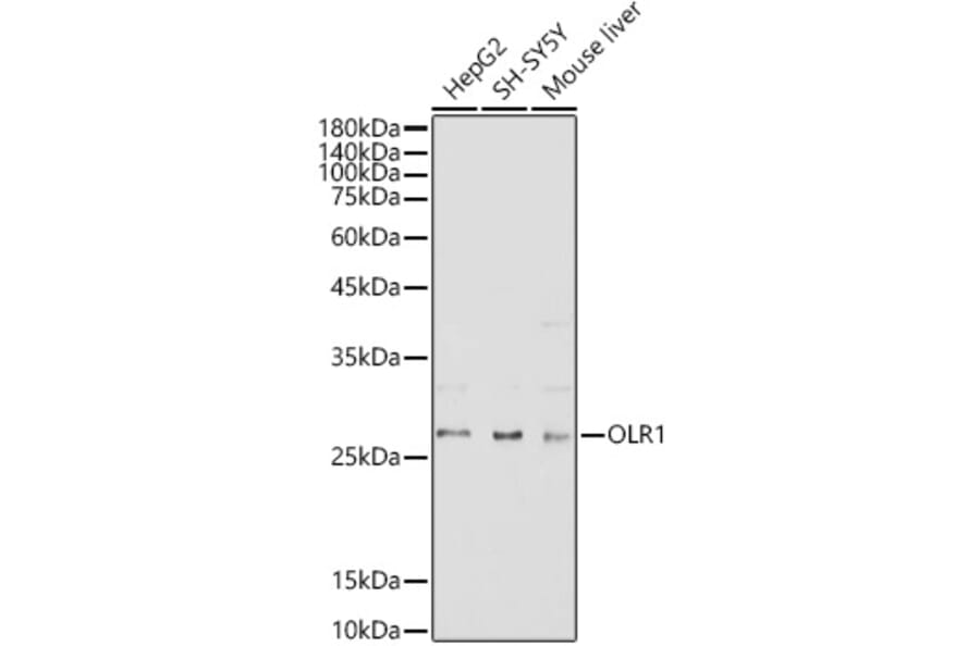 Western Blot - Anti-LOX 1 Antibody (A11465) - Antibodies.com