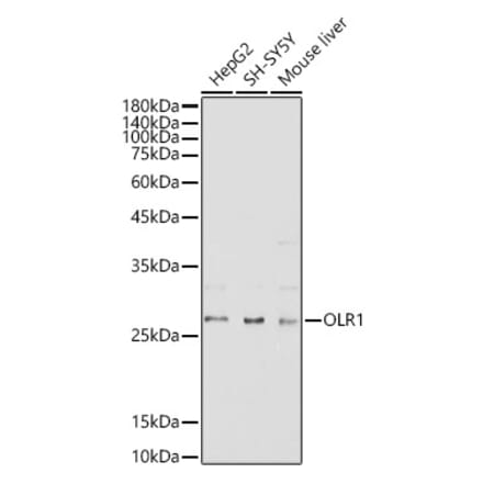 Western Blot - Anti-LOX 1 Antibody (A11465) - Antibodies.com