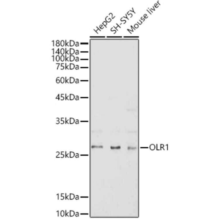 Western Blot - Anti-LOX 1 Antibody (A11465) - Antibodies.com