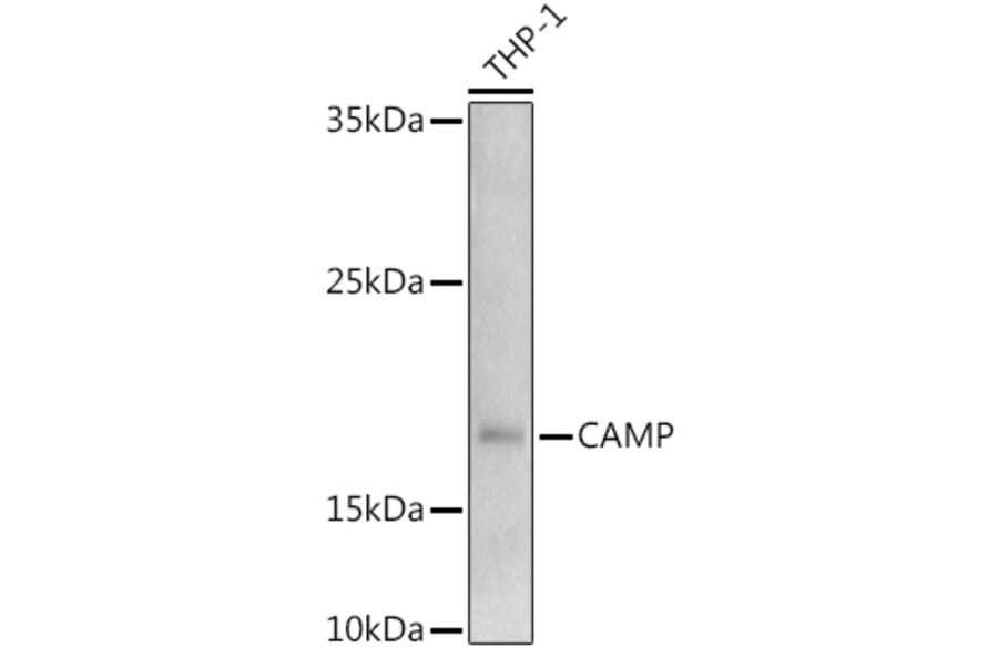 Western Blot - Anti-Cathelicidin/CLP Antibody (A11466) - Antibodies.com