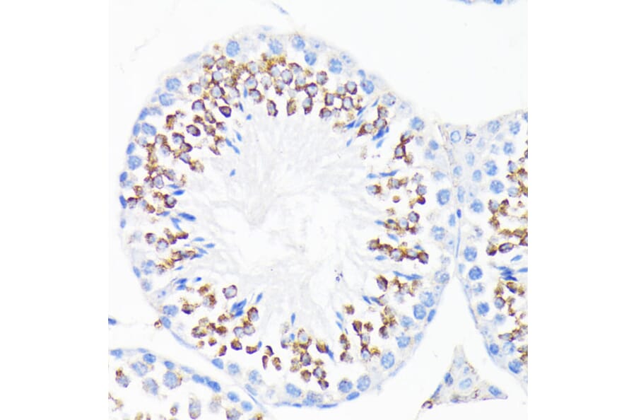 Immunohistochemistry - Anti-Cathelicidin/CLP Antibody (A11466) - Antibodies.com