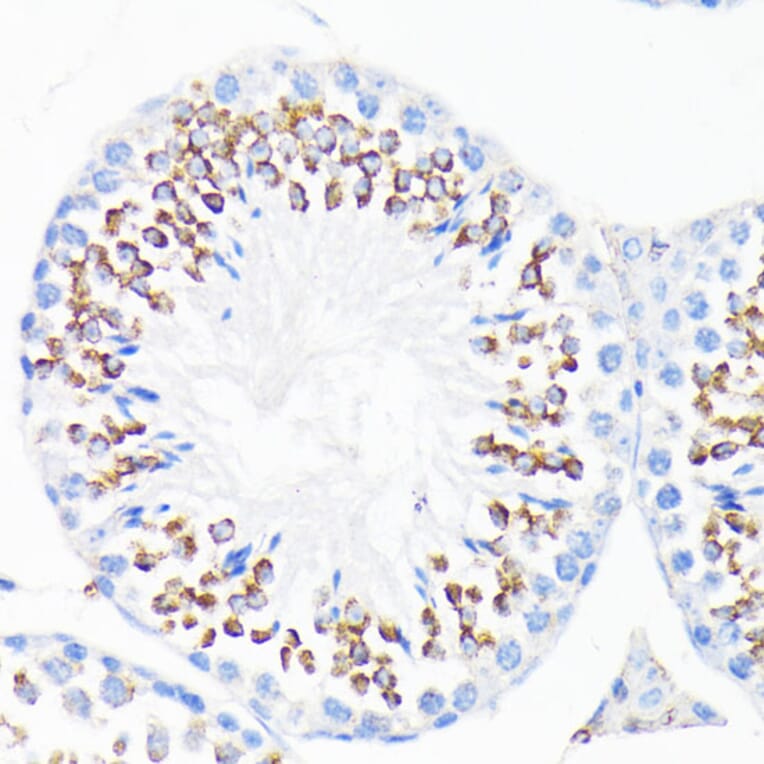 Immunohistochemistry - Anti-Cathelicidin/CLP Antibody (A11466) - Antibodies.com