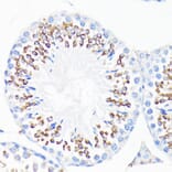 Immunohistochemistry - Anti-Cathelicidin/CLP Antibody (A11466) - Antibodies.com