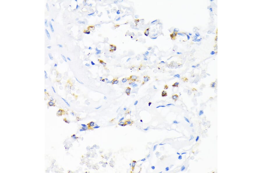 Immunohistochemistry - Anti-Cathelicidin/CLP Antibody (A11466) - Antibodies.com