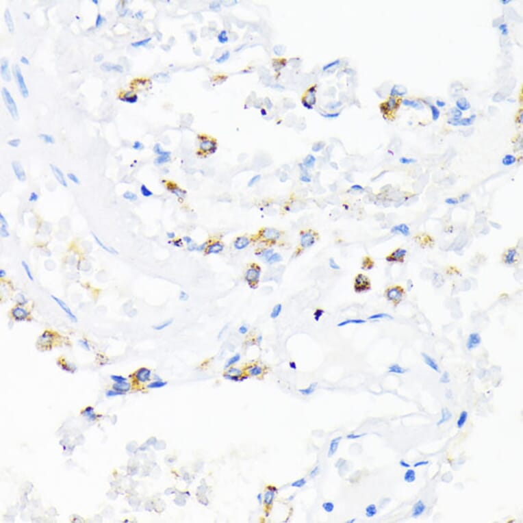Immunohistochemistry - Anti-Cathelicidin/CLP Antibody (A11466) - Antibodies.com