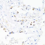 Immunohistochemistry - Anti-Cathelicidin/CLP Antibody (A11466) - Antibodies.com