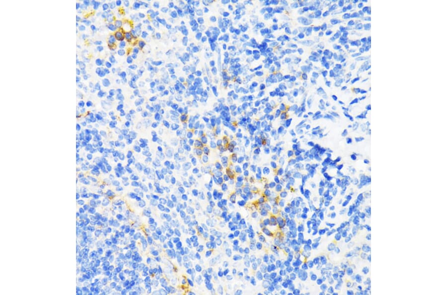 Immunohistochemistry - Anti-Cathelicidin/CLP Antibody (A11466) - Antibodies.com