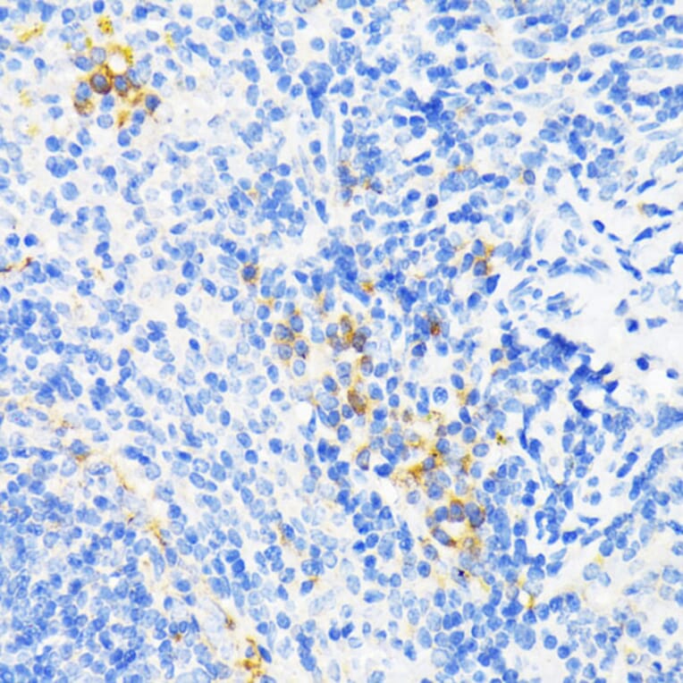 Immunohistochemistry - Anti-Cathelicidin/CLP Antibody (A11466) - Antibodies.com