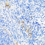 Immunohistochemistry - Anti-Cathelicidin/CLP Antibody (A11466) - Antibodies.com